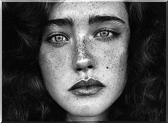 Black And White Photo Of A Girl Who Has Many Freckles